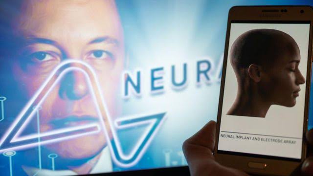  Musk asegura que ya se implantó el primer chip cerebral de Neuralink en un ser humano