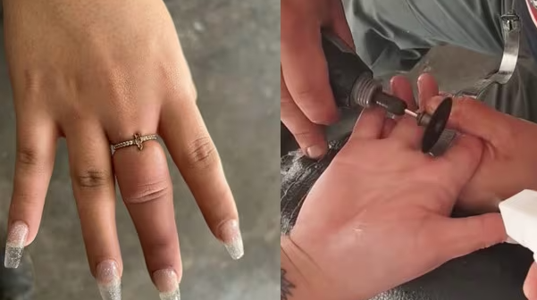  Mujer se atora el dedo en un anillo y tuvo que llamar hasta a los bomberos a su rescate