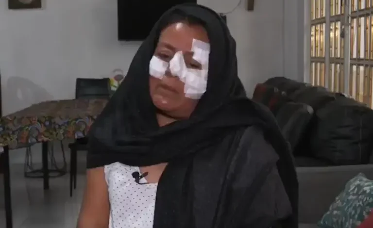  Explosión Iztapalapa: profesora vio a joven envuelto en llamas