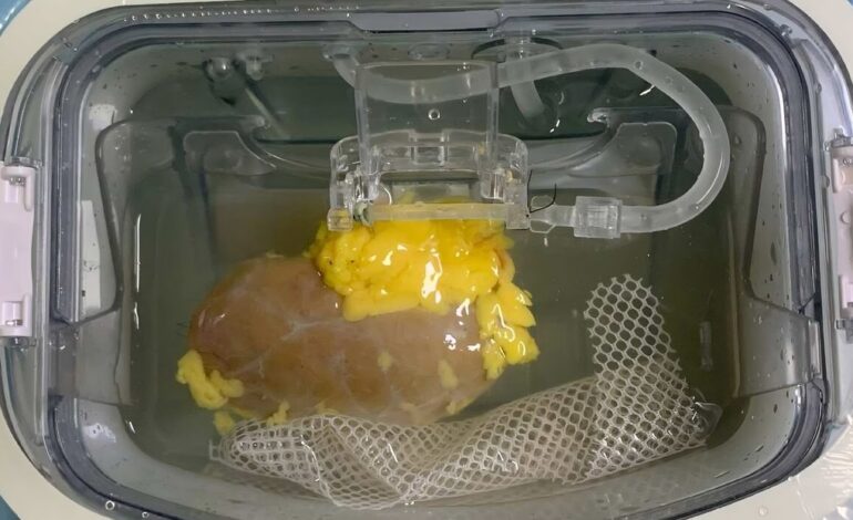  Científicos crean un riñón ‘universal’ compatible con cualquier paciente
