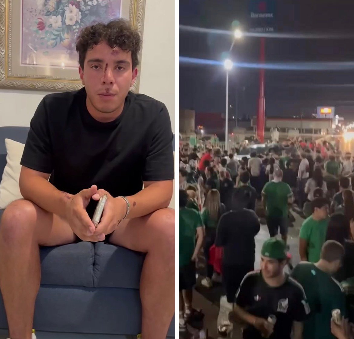 “Solo íbamos cruzando la calle”: Reaparece joven que fue atropellado en festejo de la selección; pide justicia para amiga hospitalizada