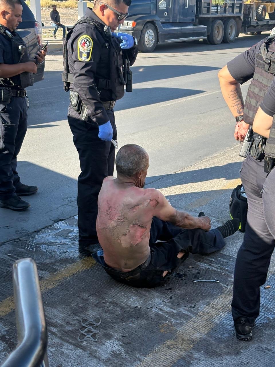 Hombre con presuntos problemas de adicción se baña en gasolina y se prende fuego