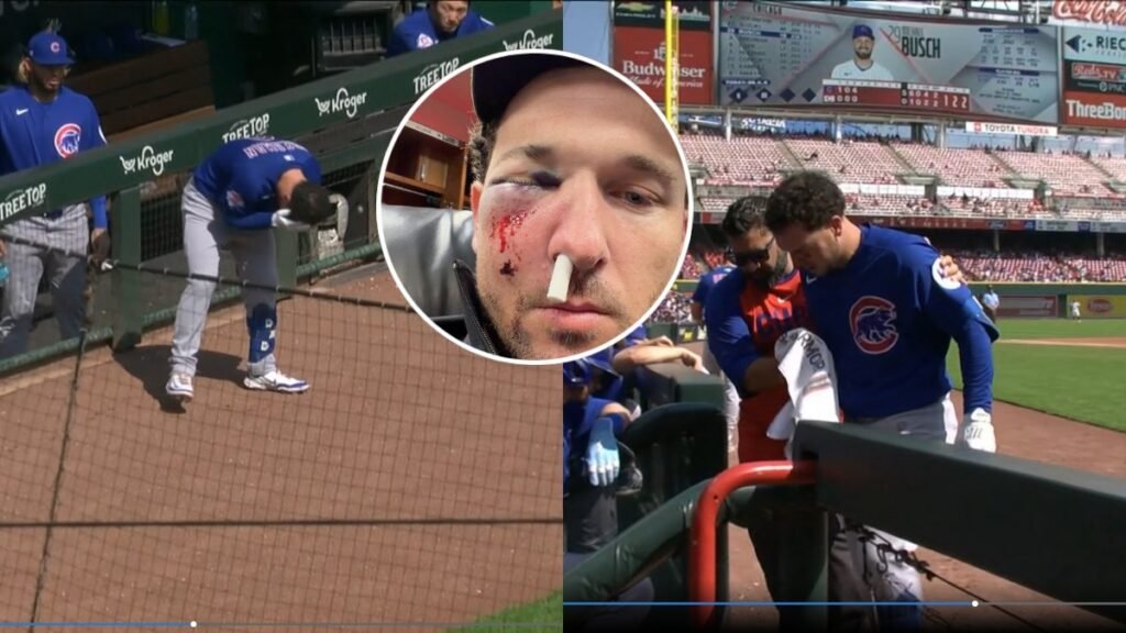 Alex Bregman abandona juego tras recibir pelotazo en la cara
